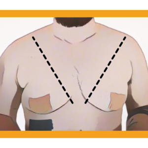 BINDING WITH TRANSTAPE – Transtape, Trans Tape For Chest Binding